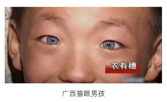 中国の青い猫目を持つ少年が話題に