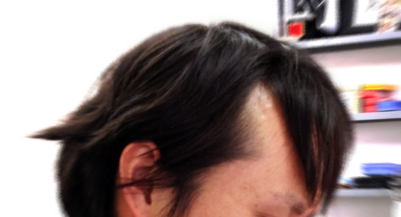 【はやく！】東京理科大が「髪の毛が生える器官」の再現に成功！ 抜け毛の根本的な治療法になるかも!!
