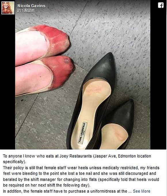 【女はつらいよ】ハイヒールで立ち仕事をしていた女性がSNSで「トンでもない状態になった足」を公開し話題に！