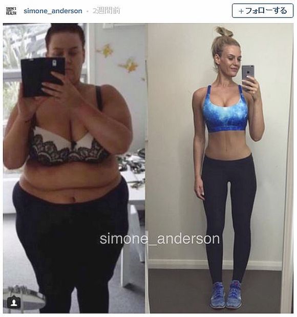 体重170キロだった女性が「2年で92キロもの減量」に成功！ その変貌ぶりに度肝を抜かれるぞ!!