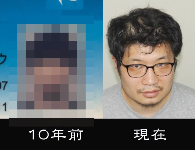 薄毛の告白 私が10年間に失った 髪の毛の量 がエグい 毛量が多くてもハゲる奴はハゲるってことを証明する逆ビフォーアフター ロケットニュース24