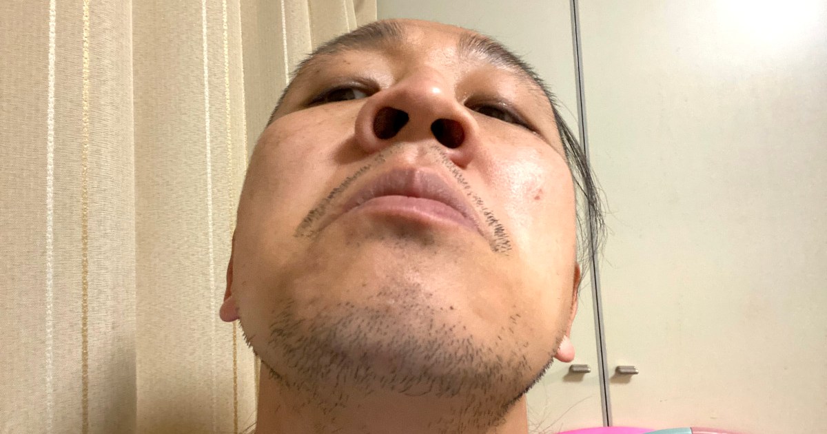 たまに鼻の奥から出てくる 黄色くてメッチャ臭いツブ は何なのか 耳鼻科の先生に聞いてみた ロケットニュース24