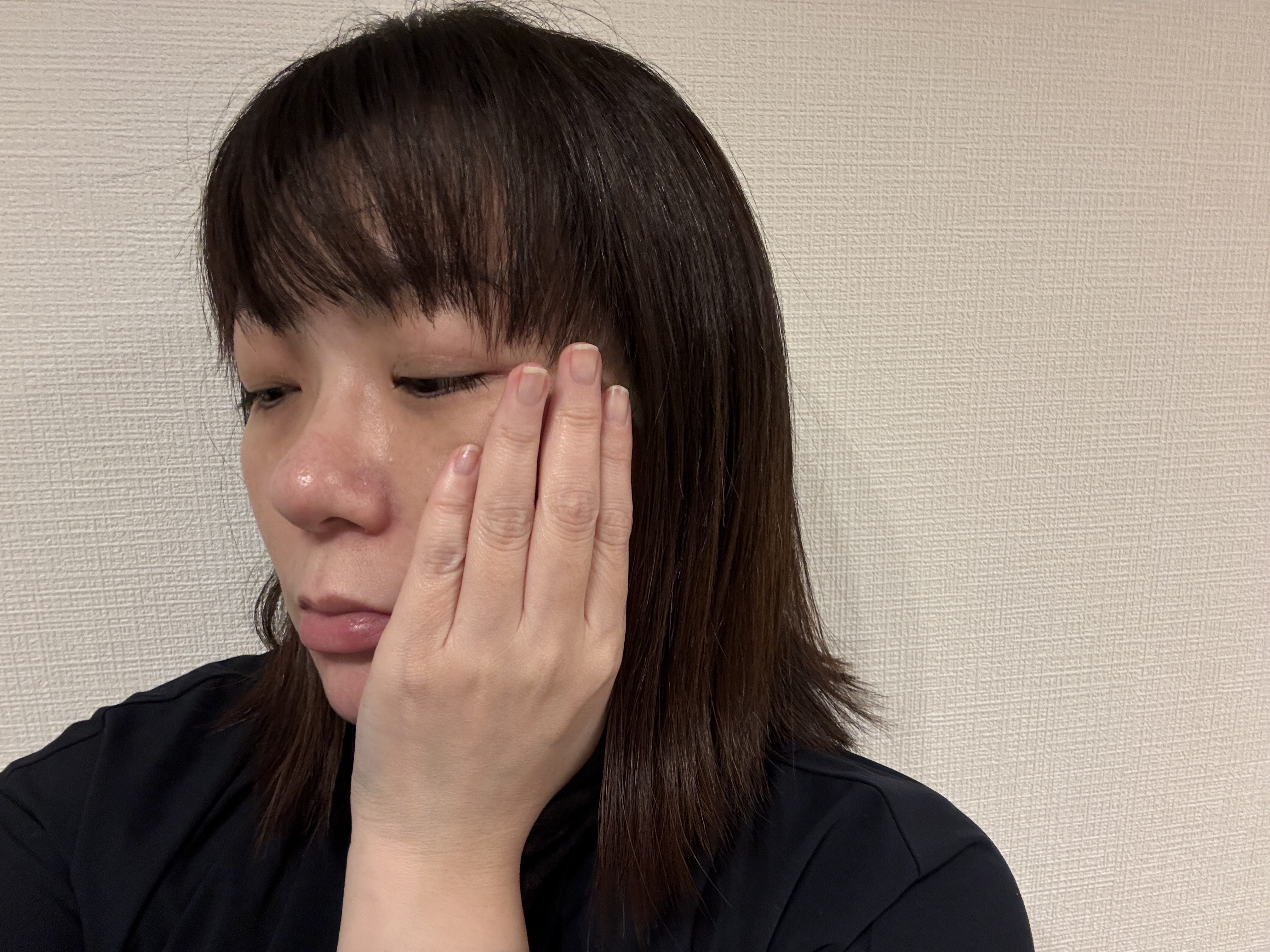 やめたらどうなる？ 美容医療をストップして4ヶ月…肌に起きた変化について【40代女子の自腹レボリューション第24回】