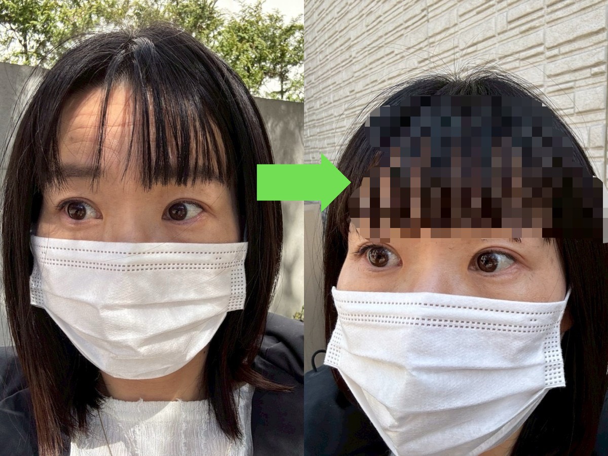 【正直レビュー】前髪エクステをやってみて感じたメリットとデメリット。最終的に出した結論はリピートしないかもだが…