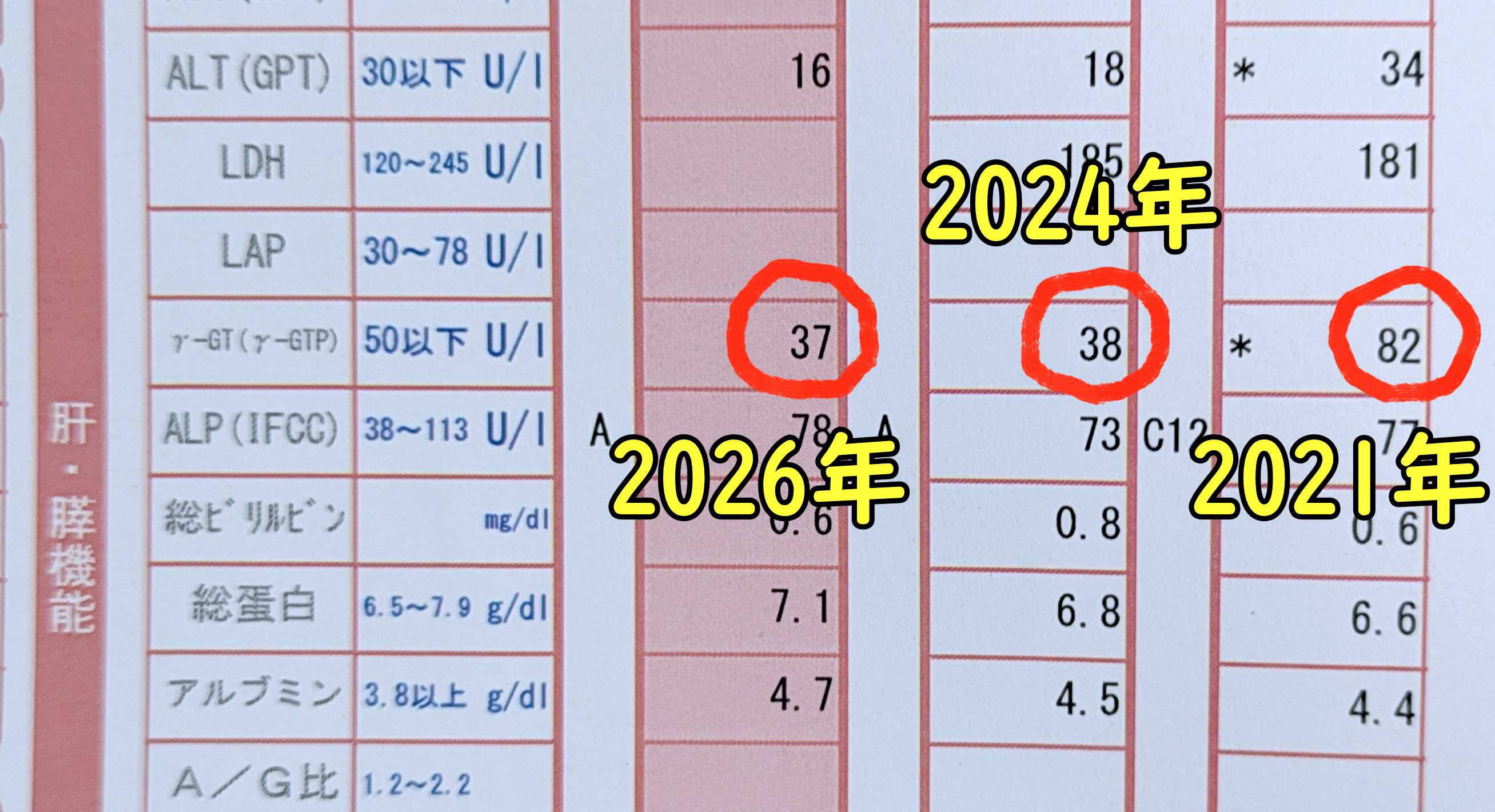 10年の運動習慣で肝臓の数値激変 / 2017年比「ガンマ値 252→37」への超改善と、AI予測の「運動しなかった未来」の恐怖