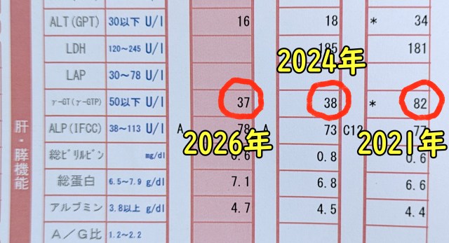 10年の運動習慣で肝臓の数値激変 / 2017年比「ガンマ値 252→37」への超改善と、AI予測の「運動しなかった未来」の恐怖